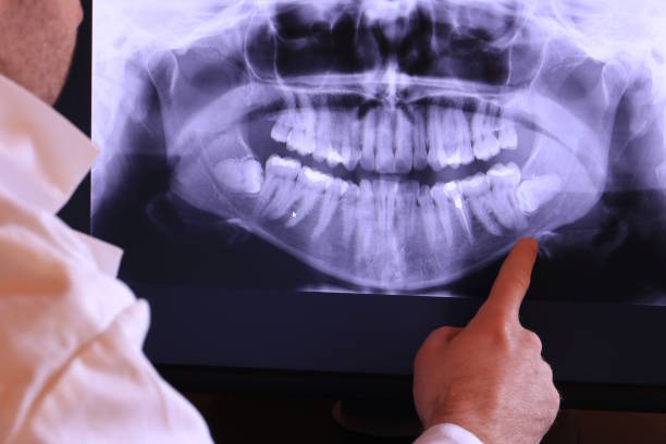 Best Emergency Dental Surgery in Hercules, CA