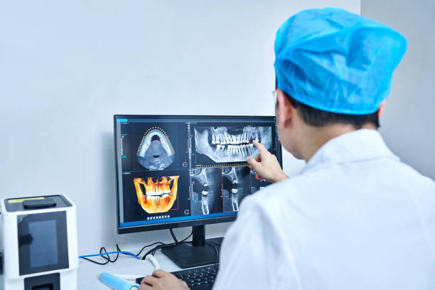 Best Emergency Root Canal Treatment in Hercules, CA